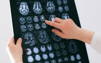 Neue Erkenntnisse zu CKD und Gehirnentzündung: Silke Zimmermann erhält Ivar Trautschold Preis