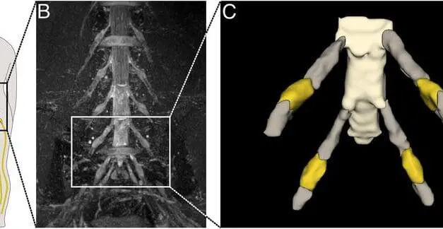 KI-gestützte Bildgebung eröffnet neue Wege in der Schmerzforschung