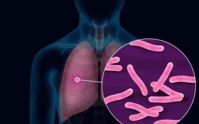 UC3M stellt drei Forschungsprojekte zur Tuberkulose vor
