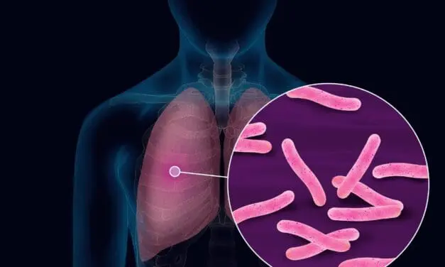 UC3M stellt drei Forschungsprojekte zur Tuberkulose vor