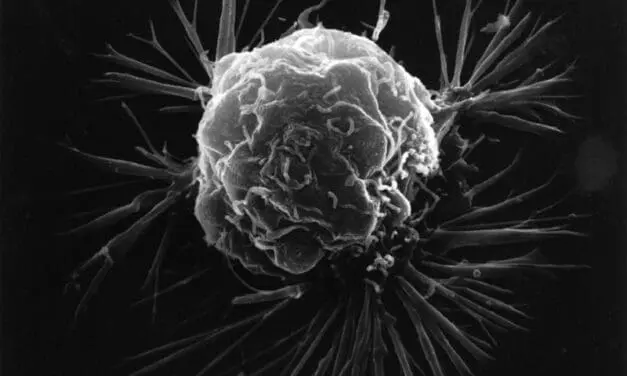 Brustkrebs: 44. Jahreskongress der Deutschen Gesellschaft für Senologie in Stuttgart