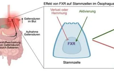 FXR: Neue Erkenntnisse zur Vorbeugung von Speiseröhrenkrebs