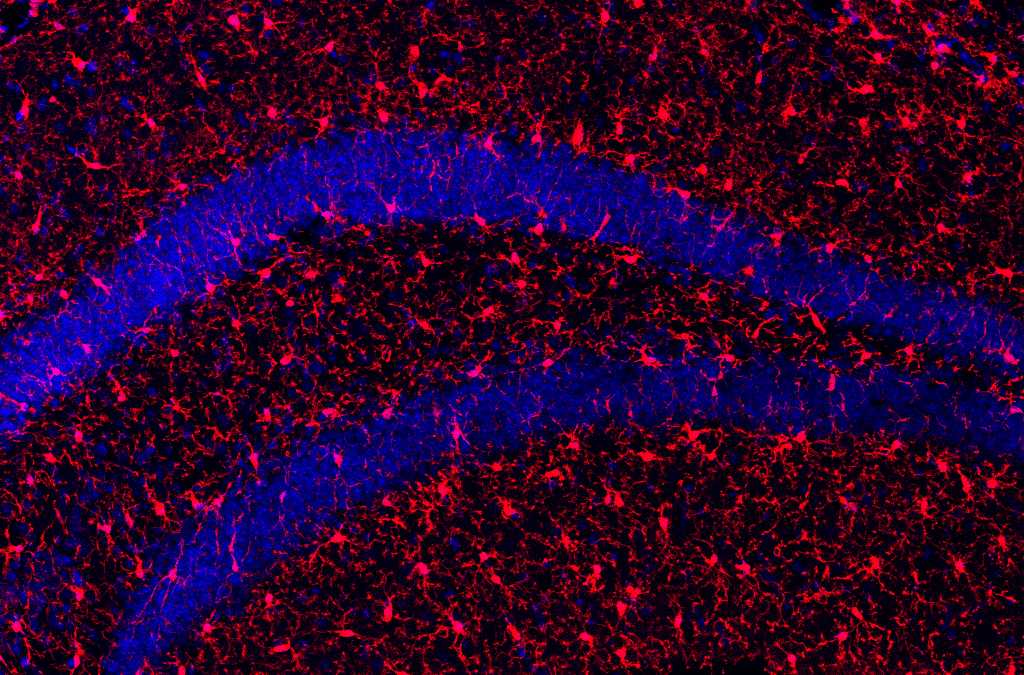 Klotho-Protein verlängert Lebensspanne und fördert Gesundheit im Alter