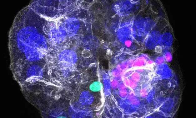 Neues Leberorganoid revolutioniert Erforschung von Lebererkrankungen