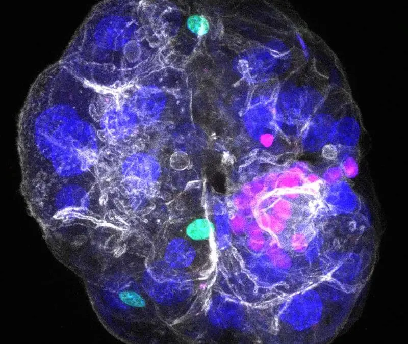 Neues Leberorganoid revolutioniert Erforschung von Lebererkrankungen