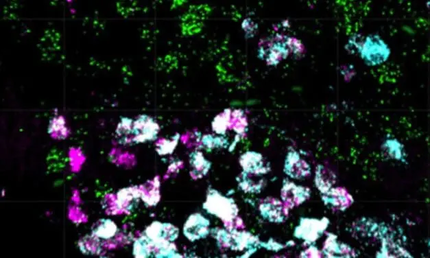 Nervenzellen im Gehirn regulieren das Körpergewicht