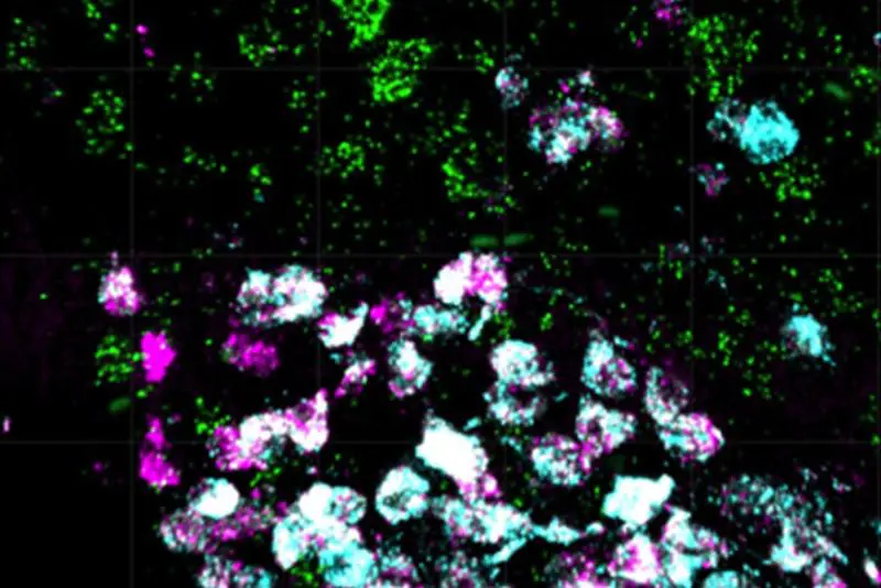 Mikroskopische Aufnahme von Nervenzellen im Mäusegehirn. | Copyright: M. Holms / Max-Planck-Institut für Stoffwechselforschung