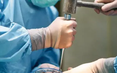 Neue S3-Leitlinie: ASS als Option zur Thromboseprophylaxe bei Hüft- und Knie-OPs