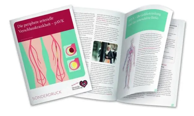 Unbehandelt gefährlich: Herzstiftung warnt vor pAVK