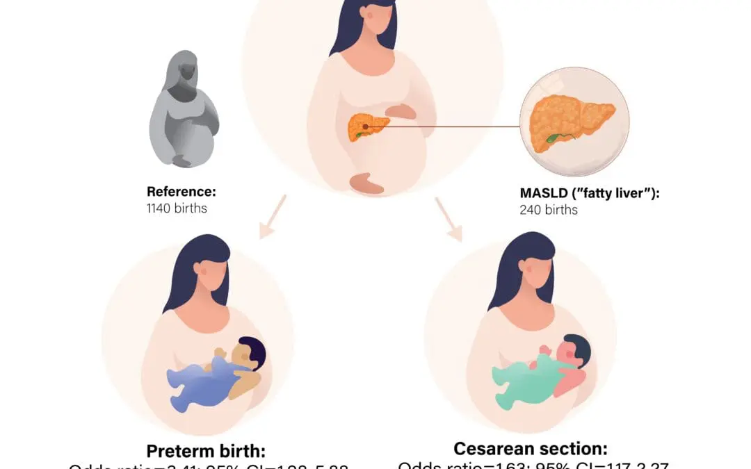 Fettleber in der Schwangerschaft kann das Risiko einer Frühgeburt erhöhen