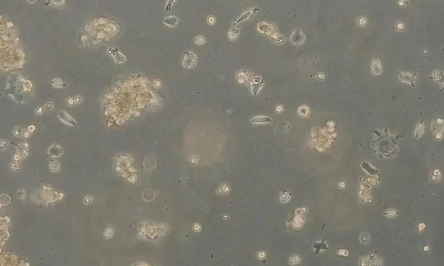 Antivirale Textilien: DITF-Labor weist hohe Wirksamkeit gegen Coronaviren nach