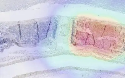 TUM-Forschende entwickeln Verfahren zur Verfolgung von manipulierten Immunzellen