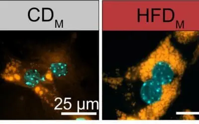 Übergewicht der Mutter programmiert Stoffwechsel der Nachkommen bereits im Mutterleib um