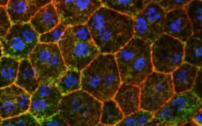 Cholesterinstoffwechsel bietet neuen Ansatz gegen Makuladegeneration