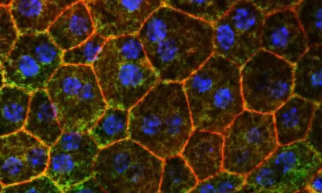 Cholesterinstoffwechsel bietet neuen Ansatz gegen Makuladegeneration