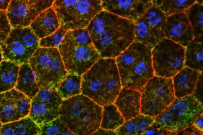 Die Behebung von Problemen mit dem Cholesterinstoffwechsel könnte dazu beitragen, eine häufige Ursache für altersbedingten Sehverlust zu verlangsamen oder zu verhindern, wie eine neue Studie von WashU Medicine an Mäusen gezeigt hat. Das Bild zeigt farblich gefärbte Epithelzellen der Netzhaut eines Mäuseauges, die ersten Zellen, die bei fortschreitender altersbedingter Makuladegeneration absterben. Credits: Tim Lee