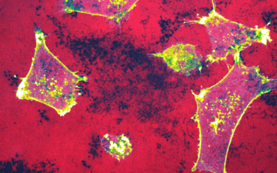 MiROM-Technologie ermöglicht schnelle Bewertung von Krebsbehandlungen ohne Marker