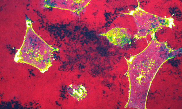 MiROM-Technologie ermöglicht schnelle Bewertung von Krebsbehandlungen ohne Marker