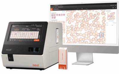 Malariadiagnostik neu gedacht: Schnell, präzise, nachhaltig