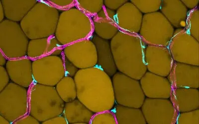 Bauchfett gefährdet Blutgefäße: Neue Erkenntnisse aus Göttingen