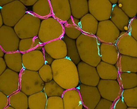 Bauchfett gefährdet Blutgefäße: Neue Erkenntnisse aus Göttingen