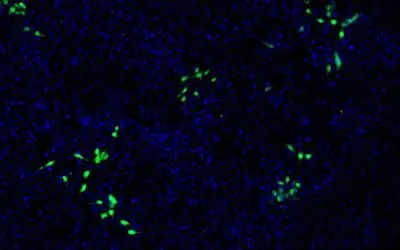 Hepatitis E-Virus befällt auch Nierenzellen: Neue Erkenntnisse erschweren Therapie