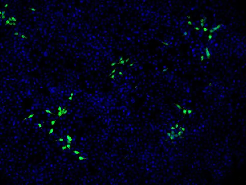 Mit HEV infizierte Nierenzellen sind mit einem grünen Fluoreszenzfarbstoff markiert. Nicht infizierte Zellen sind blau angefärbt. | Copyright: © TWINCORE