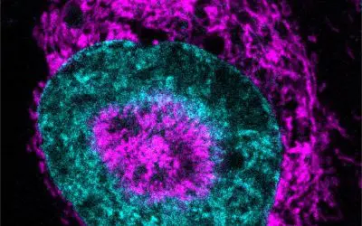 Krebszellen unter Druck nutzen Energieschub zur DNA-Reparatur