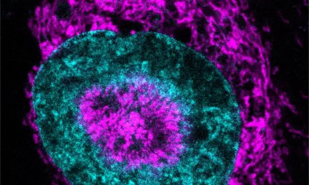 Krebszellen unter Druck nutzen Energieschub zur DNA-Reparatur
