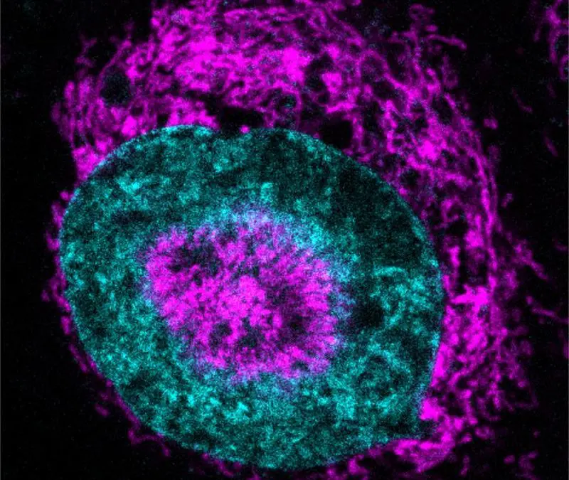 Krebszellen unter Druck nutzen Energieschub zur DNA-Reparatur