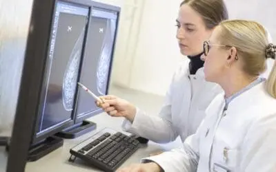 Mammographie-Screening erhöht Entdeckung früher Brustkrebsfälle deutlich