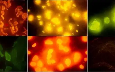 Neue Methoden zum Nachweis von Mikroplastik in Fisch und Meeresfrüchten vorgestellt