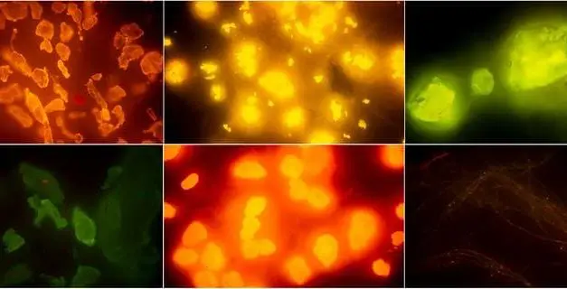 Neue Methoden zum Nachweis von Mikroplastik in Fisch und Meeresfrüchten vorgestellt