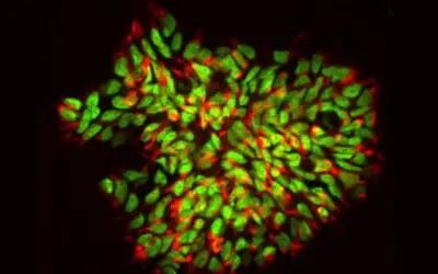Multiple Sklerose: Stammzellen reparieren Nervenschäden