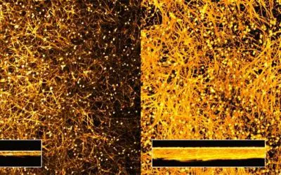 Sensation: Albumin löst Pilzvirulenz aus