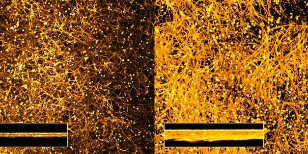 Sensation: Albumin löst Pilzvirulenz aus