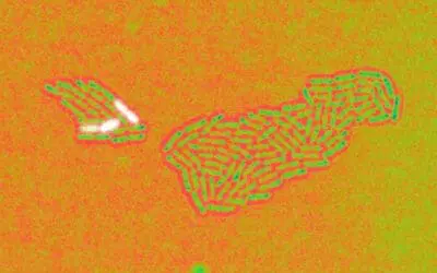 Pseudomonas aeruginosa: Helmholtz-Zentrum entschlüsselt Überlebensstrategie des Krankenhauskeims