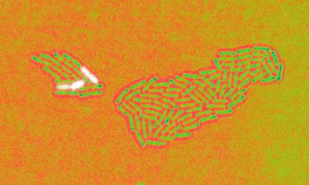 Pseudomonas aeruginosa: Helmholtz-Zentrum entschlüsselt Überlebensstrategie des Krankenhauskeims