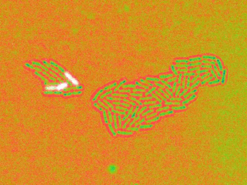 Zellen von Pseudomonas aeruginosa in Falschfarben dargestellt. Weiße Zellen weisen eine hohe Aktivität des Promotors des Gens glpD auf. | Quelle: Anika Steffen | Copyright: HZI/Anika Steffen