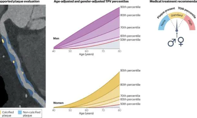 Neue Empfehlungen zur individualisierten Behandlung von Arterienverkalkungen durch KI-gestützte CT-Analyse