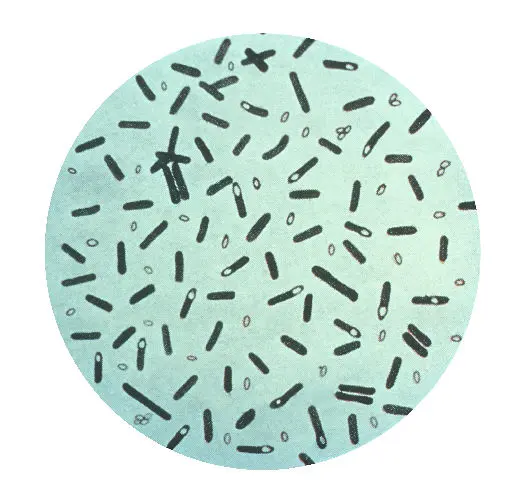 Clostridium botulinum. Credits: CDC