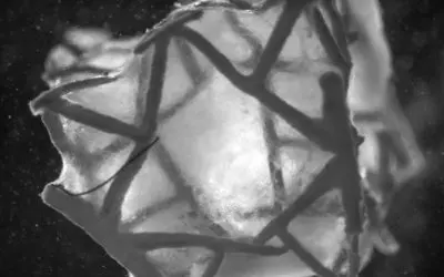 Neuartiges Herzpflaster aus Zürich: Heilung statt bloßer Verschluss