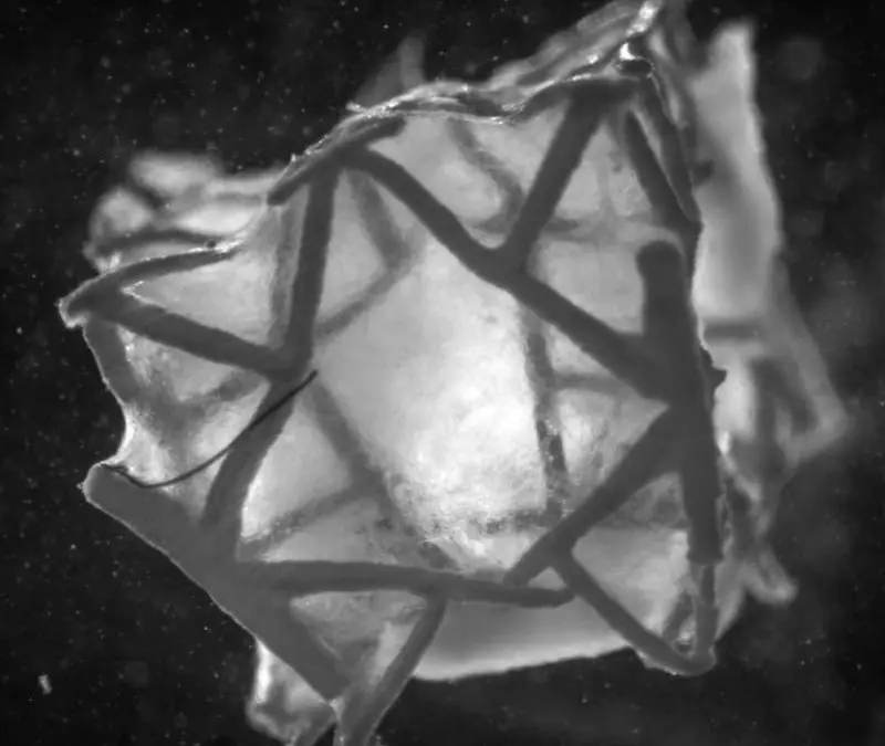 Neuartiges Herzpflaster aus Zürich: Heilung statt bloßer Verschluss