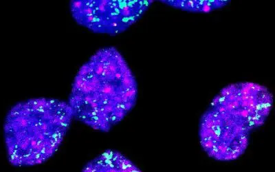 Neuer Therapieansatz gegen aggressive Neuroblastome entdeckt