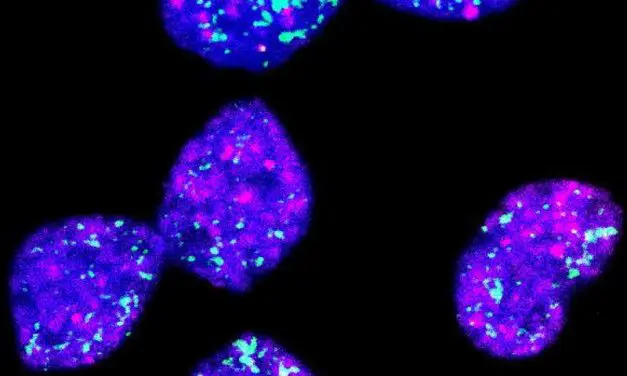 Neuer Therapieansatz gegen aggressive Neuroblastome entdeckt