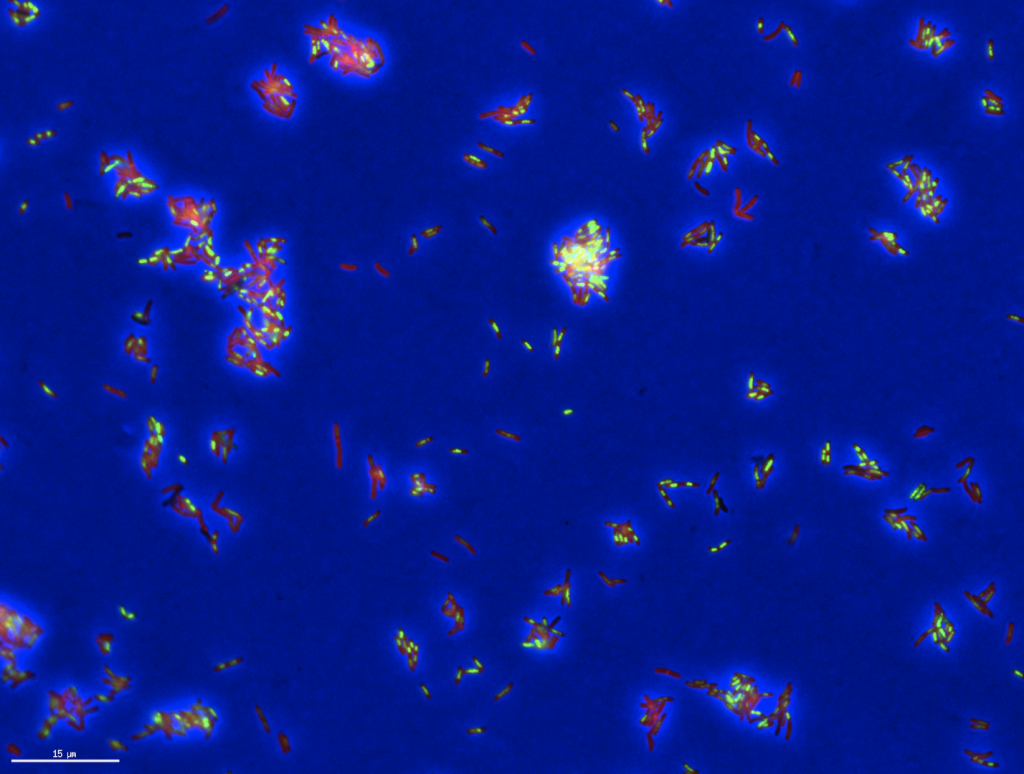 Ein "Todesporträt" von TB-Bakterien, die mit einem Antibiotikum behandelt und angefärbt wurden, um die physischen Merkmale der einzelnen Zellen zu zeigen. Bild: Mit freundlicher Genehmigung des Aldridge-Labors