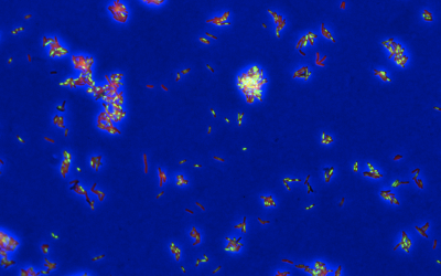 KI-Methode DECIPHAER verbessert Verständnis von Tuberkulose-Behandlungen