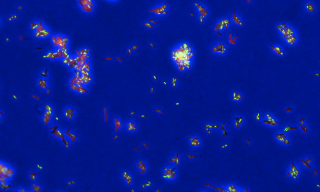 KI-Methode DECIPHAER verbessert Verständnis von Tuberkulose-Behandlungen