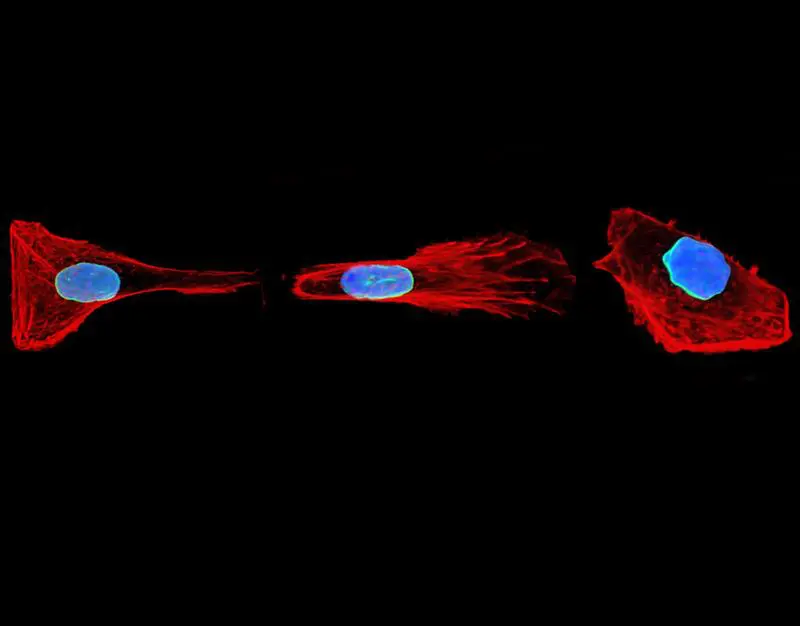 Zellen verändern ihre Gestalt, um sich durch komplexe Strukturen zu bewegen. | Quelle: Yohalie Kalukula | Copyright: Yohalie Kalukula, Universität Mons