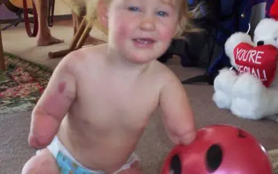 Welt-Sepsis-Tag 2025: Prävention und Schutz vor Meningokokken-Erkrankungen